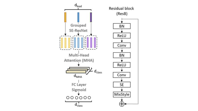 Mixed-Domain Self-Attention Network - Inventec AI Center