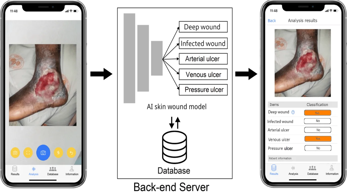 AIC-16__wound_app_overview